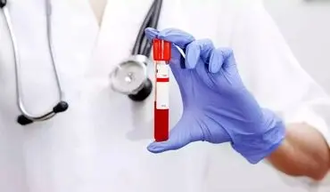 علت تجویز آزمایش خون پرولاکتین چیست؟