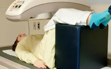 از چه سنی تست پوکی استخوان بدهیم؟
