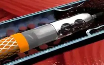 
دستگاهی حیرت انگیز برای خروج لخته‌های خون از بدن + فیلم