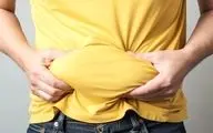 دور کمر چقدر باشد چاقی شکمی به حساب می آید؟


