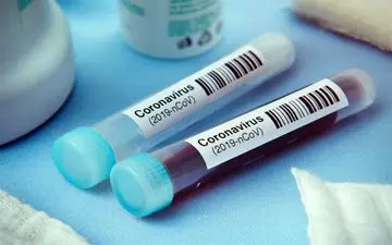 کیت‌‌ ایرانی تشخیص کرونا آماده عرضه جهانی/ تولید ۸۰ هزار کیت تشخیصی در هر هفته