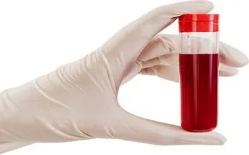 علایم هشدار دهنده‌ای که از گردش خون ضعیف حکایت دارند