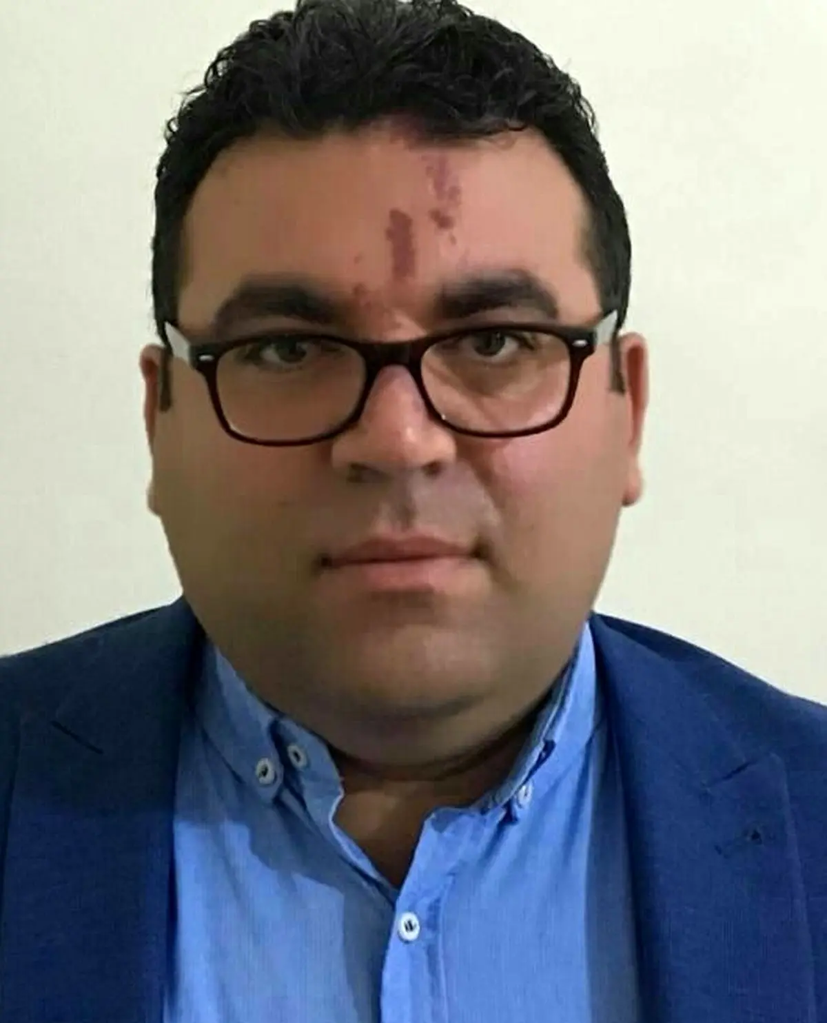 ریکاوری بودجه و دیالیز سیاست

