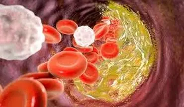 وجود خون در ادرار بسیار خطرناک است!