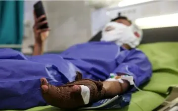 مصدومان حوادث چهارشنبه پایان سال به چند نفر رسیدند؟
