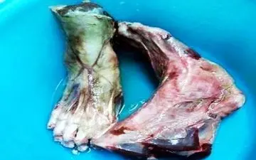 فروش پاهای بریده شده انسان در رستوران! + عکس