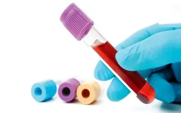 مردم تهران برای اهدای خون هرچه سریعتر بشتابند
