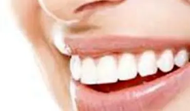 ضرورت حفظ سلامت حفره دهانی در خدمات زیبایی دندانپزشکی 