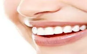 ضرورت حفظ سلامت حفره دهانی در خدمات زیبایی دندانپزشکی 