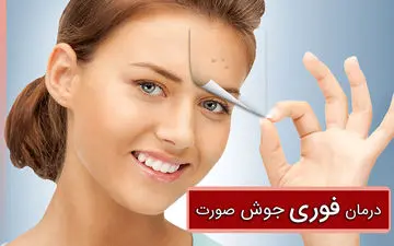 درمان فوری جوش صورت