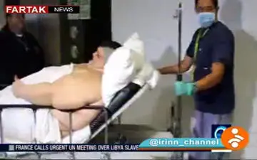 جراحی  موفقیت آمیز «بای پس معده» بر روی سنگین وزن ترین مرد جهان + فیلم