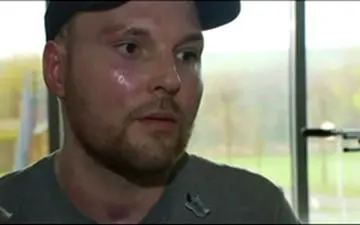 مردی که عمل پیوند پوست را با موفقیت پشت سر گذاشت + فیلم