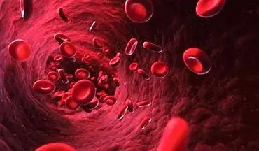 آشنایی با علائم شایع کم خونی فقر آهن 