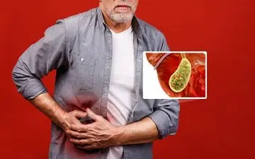 سنگ کیسه صفرا داری؟ بیا تا راه درمان خانگی اش رو بهت یاد بدم!