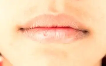 چند توصیه کاربردی برای جلوگیری از خشکی و ترک لب در ماه رمضان
