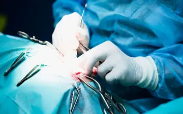 توده 4 و نیم کیلویی از شکم زن 18 ساله خارج شد/ ببینید