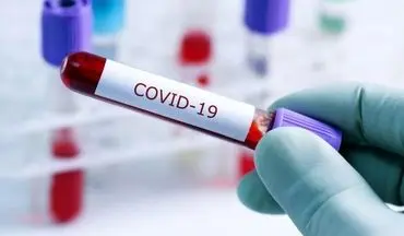 
تایید اولین آزمایش بالینی واکسن کرونا ویروس در کانادا
