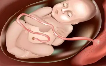 علت پایین آمدن جفت