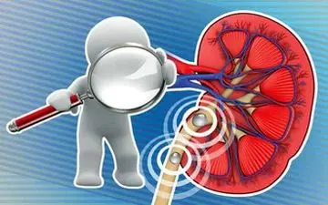  رعایت این نکات برای سلامتی کلیه ها ضروری است