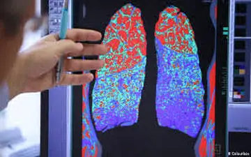 علایم کرونا در کودکان تغییر کرده است
