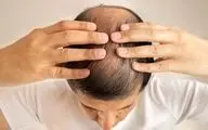 این داروی ریزش مو باعث خودکشی افراد می‌شود