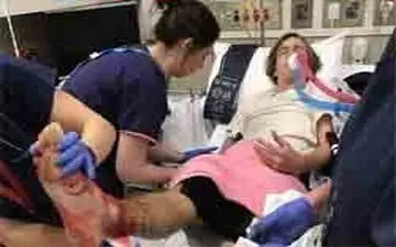 موجودات اسرارآمیز گوشت پای پسر را خوردند!