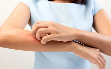 درماتیت تماسی، علل، انواع و درمان