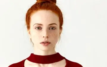 ترفندهای ساده برای محافظت از پوست دارای کک و مک در روزهای گرم
