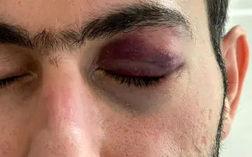 
 عامل حمله دردناک به پزشک بندرعباسی بازداشت شد+عکس
