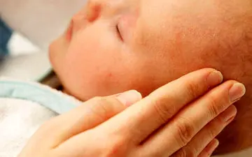 پوسته شدن ملاج نوزاد چیست و چه علائمی دارد؟