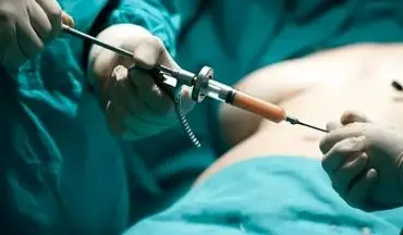 BBL، پرریسک‌ترین و پشیمان‌کننده‌ترین جراحی ۲۰۲۵؛ موج پشیمانی سلبریتی‌ها و زنان از لیفت باسن برزیلی!