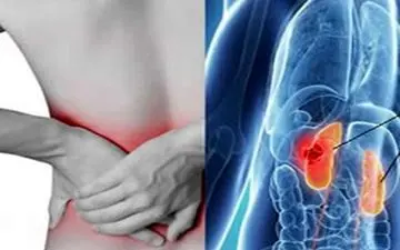  آشنایی با علامت عفونت کلیه