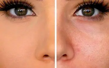 منافذ پوست را چگونه تمیز کنیم ؟ / نکات و روش های عالی باز کردن منافذ پوستی 