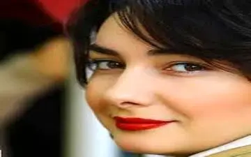 تغییرات ظاهری مشهود خانم بازیگر مشهور