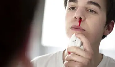 
چند راه‌های برخورد با خونریزی بینی