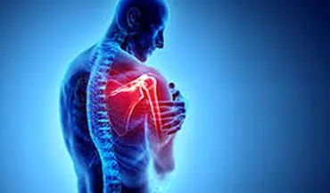 این بیماران به شانه یخ زده دچار می شوند