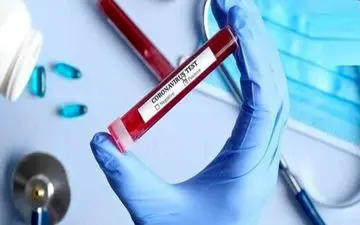 
۷ گام آسان پیشگیری از شیوع کرونا + فیلم