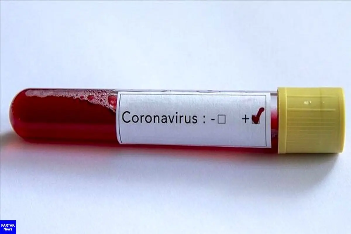 درمان ویروس کرونا با پلاسمای خون افراد بهبود یافته
