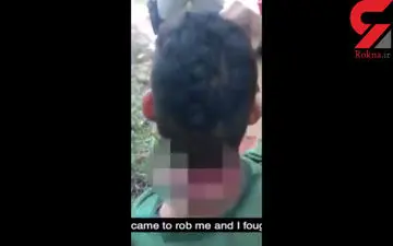 عجیب و واقعی/جوانی که با سر بریده راه رفت تا نجات یابد+ فیلم 