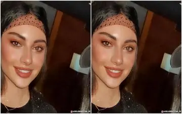 جراحی عجیب و باورنکردنی ترلان پروانه / چهره باورنکردنی ترلان پروانه !! + عکس