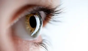 روش‌های تشخیص "بدرنگ بینی" / بیمارانی که دنیا را خاکستری می‌بینند