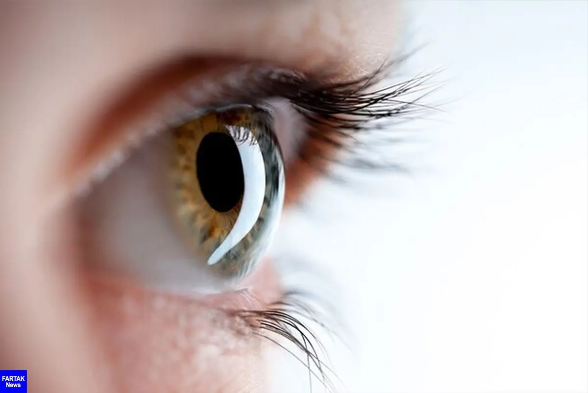 روش‌های تشخیص "بدرنگ بینی" / بیمارانی که دنیا را خاکستری می‌بینند