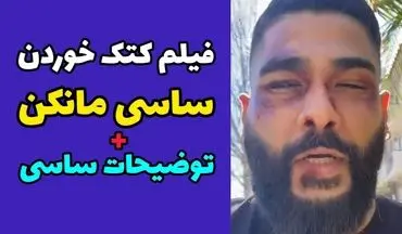 ساسی مانکن به کام مرگ کشیده شد / کتک خوردن وحشتناک ساسی در آمریکا به خاطر یک دختر + ویدئو ناراحت کننده