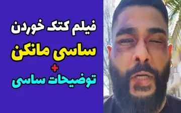 ساسی مانکن به کام مرگ کشیده شد / کتک خوردن وحشتناک ساسی در آمریکا به خاطر یک دختر + ویدئو ناراحت کننده
