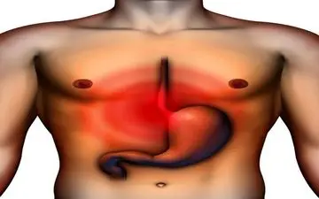 گاستریت چیست؟