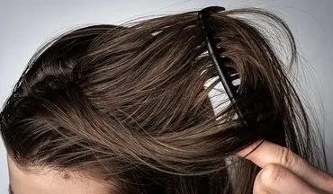 دلیل زود چرب شدن موی سر چیست؟| راه حل خانگی برای کاهش چربی کف سر

