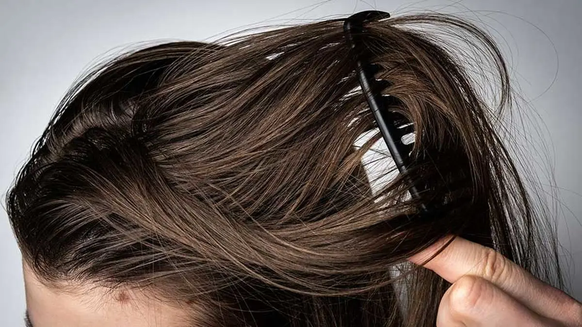 دلیل زود چرب شدن موی سر چیست؟| راه حل خانگی برای کاهش چربی کف سر

