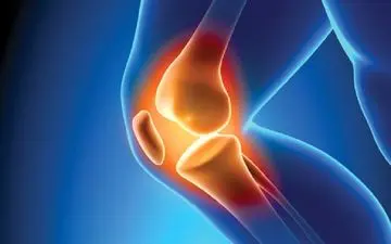 توصیه های مهم برای درمان زانوی ملتهب