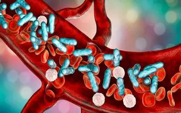 مسمومیت خون؛ از دلایل تا درمان