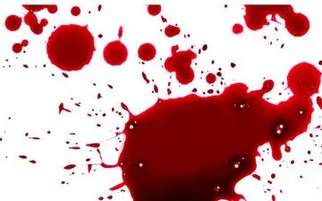 سقوط مرگبار دزد فراری از دست پلیس 